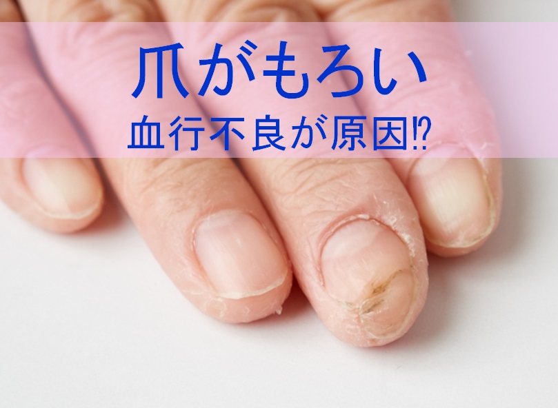 爪の血色が悪い人は要注意 血行不良で爪がペラペラに 日本ハンドビューティー協会